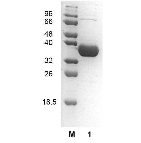D-Alanine aminotransferase (EC 2.6.1.21), Bacillus subtilis