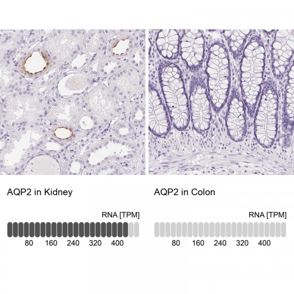 Anti-AQP2