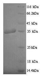 Latent membrane protein 1 (LMP1), partial, Epstein-Barr virus, recombinant