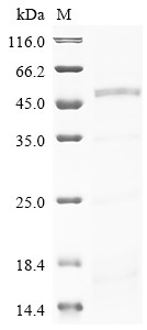 Phenylalanine-4-hydroxylase (PAH), human, recombinant