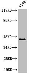 Anti-Cleaved-MASP1 (R448)