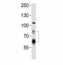 Anti-PCSK9