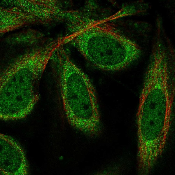 Anti-CPEB1