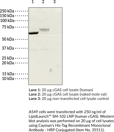LipidLaunch(TM) SM-102 LNP (human cGAS)