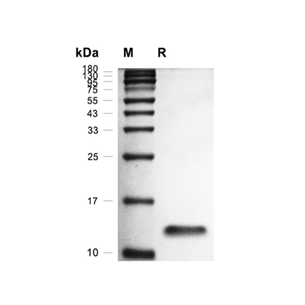 Interferon-gamma (IFNG) Recombinant (Rat)