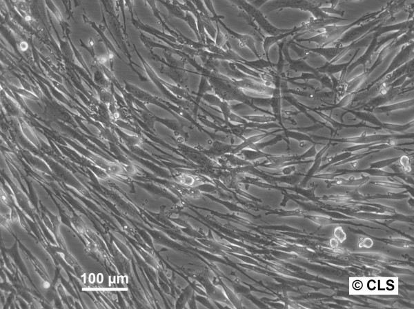 U-118 MG Cells