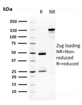 Anti-Squamous Cell Carcinoma Antigen 1 Monoclonal Antibody (Clone: CPTC-SERPINB3-2)