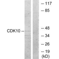 Anti-CDK10