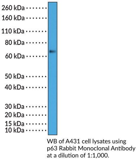 Anti-p63 Rabbit Monoclonal Antibody (Clone RM383)