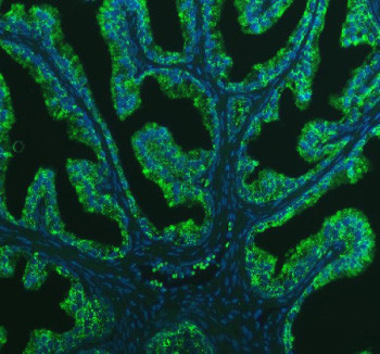 Anti-BCAP29 / B-cell receptor-associated protein 29