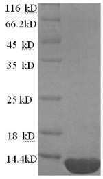 ESAT-6-like protein EsxB (esxB), Mycobacterium tuberculosis, recombinant