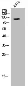 Anti-Phospho-NR3C1 (S203)