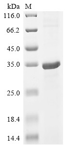 Cathepsin W (CTSW), human, recombinant