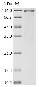 Homeobox protein Hox-A3 (HOXA3), human, recombinant