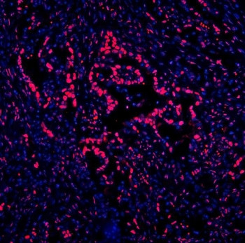 Anti-DDX5, clone 3F9