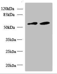 Anti-KBTBD4