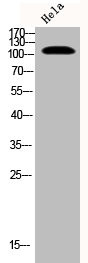 Anti-Phospho-EPHB1/EPHB2 (Y594/604)
