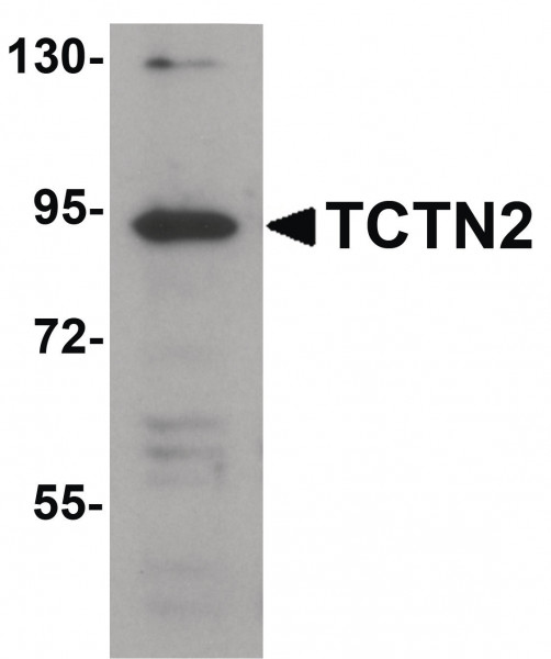Anti-TCTN2