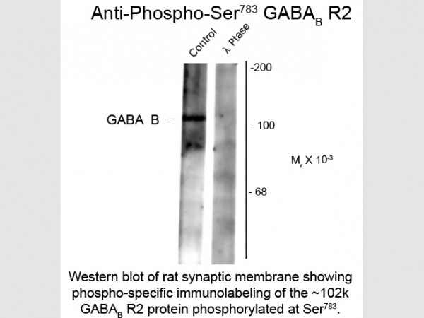 Anti-phospho-GABA(B) Receptor 2 (Ser783)
