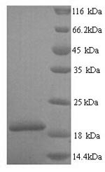 Group XIIA secretory phospholipase A2 (PLA2G12A), partial, human, recombinant