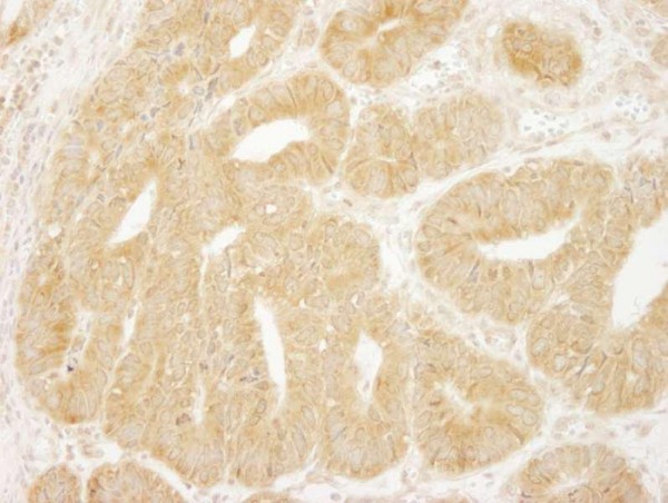 Anti-eIF2A (IHC)