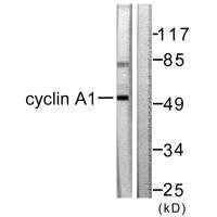 Anti-CCNA1