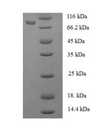 Phenylalanine--tRNA ligase alpha subunit (FARSA), human, recombinant