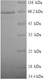 Tubulin beta-2A chain (TUBB2A), human, recombinant
