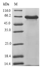2-5A-dependent ribonuclease (RNASEL), partial, human, recombinant