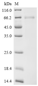 Tumor necrosis factor receptor superfamily member 6B (TNFRSF6B), human, recombinant