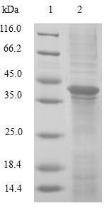 Glutaredoxin-2, mitochondrial (GLRX2), human, recombinant
