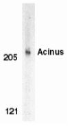 Anti-Acinus
