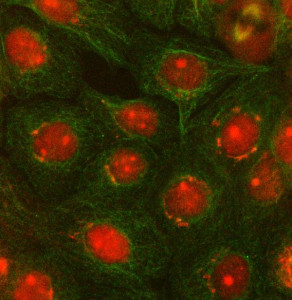 Anti-OTUD5 / OTU deubiquitinase 5