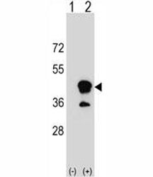 Anti-CD1b