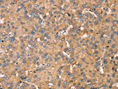 Anti-TGFB2