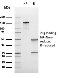 Anti-Bcl-6 (Follicular Lymphoma Marker), recombinant antibody, clone rBCL6/1475