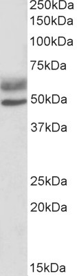 Anti-AIRE (isoforms 1 and 2), C-terminal