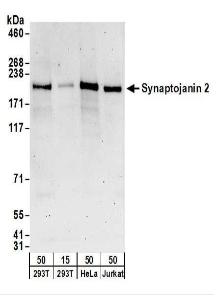 Anti-Synaptojanin 2