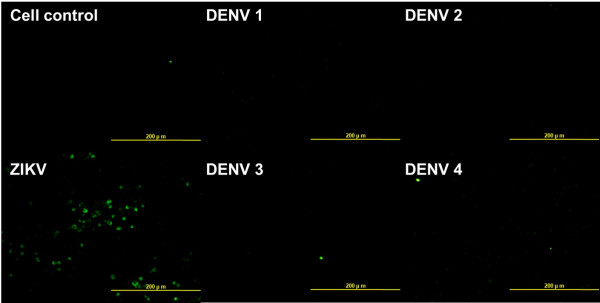 Anti-Zika virus NS1, clone SQab1609