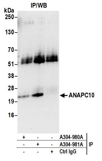 Anti-ANAPC10/APC10