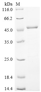 Myosin regulatory light chain 12B (MYL12B), human, recombinant
