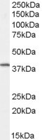 Anti-Dysadherin, C-terminal