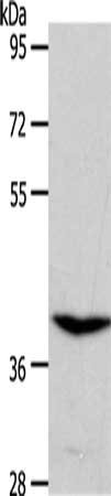 Anti-S1PR4