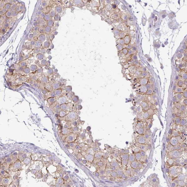 Anti-PNLDC1
