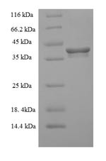 ER membrane protein complex subunit 9 (EMC9), human, recombinant