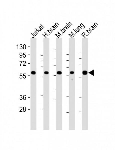 Anti-PPP2R1B, clone 1496CT356.164.25.226