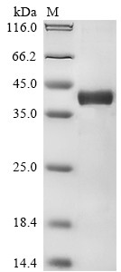 H-2 class I histocompatibility antigen, D-D alpha chain (H2-D1), mouse, recombinant