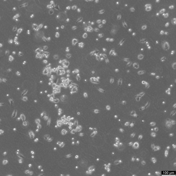 Calu-6 Cells