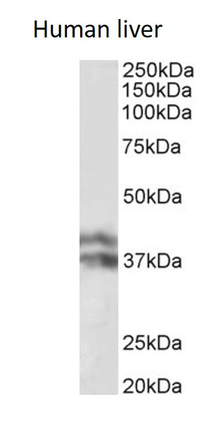 Anti-Haptoglobin