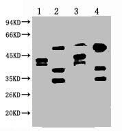 Anti-ERCC1 Monoclonal